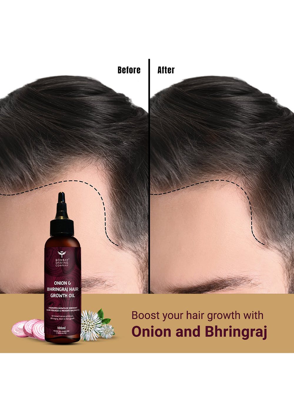 Hair loss treatment: Bhringraj oil exceeds minoxidil in study |  Express.co.uk