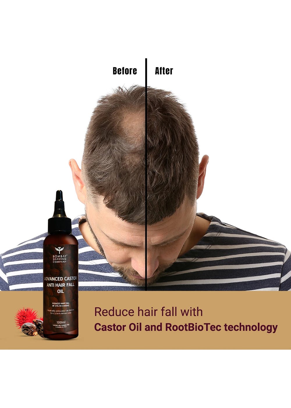 Castor Oil Hair Mask with Biotin freeshipping  Yofing