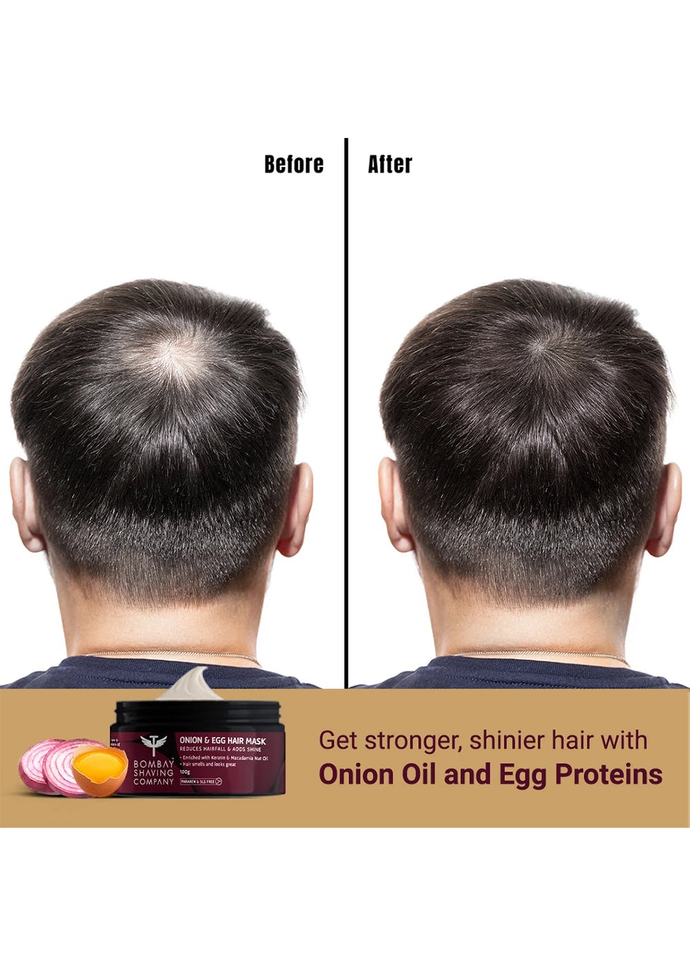 Get Hair Growth Booster Kit (Onion Bhringraj Hair Growth Oil, Advanced  Castor Anti Hair Fall Oil & Onion & Egg Hair Mask) at ₹ 649 | LBB Shop